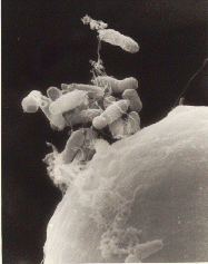 Crown gall